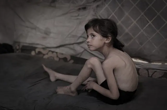 British doctor returning from Gaza. If immediate intervention is not made, deaths from hunger will spread like waves.