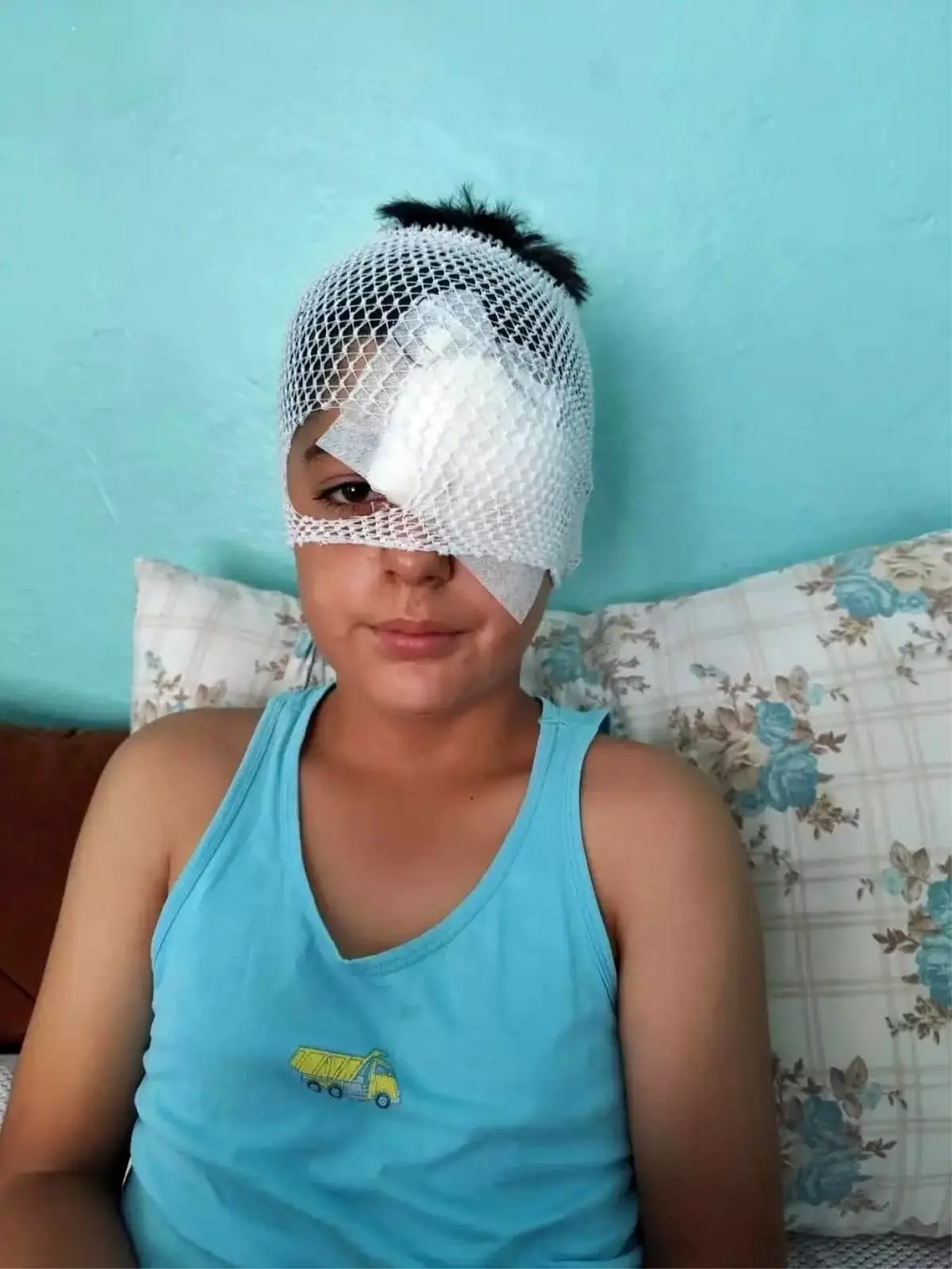 Köpek Saldırısından Kaçan Çocuğa Otomobil Çarptı