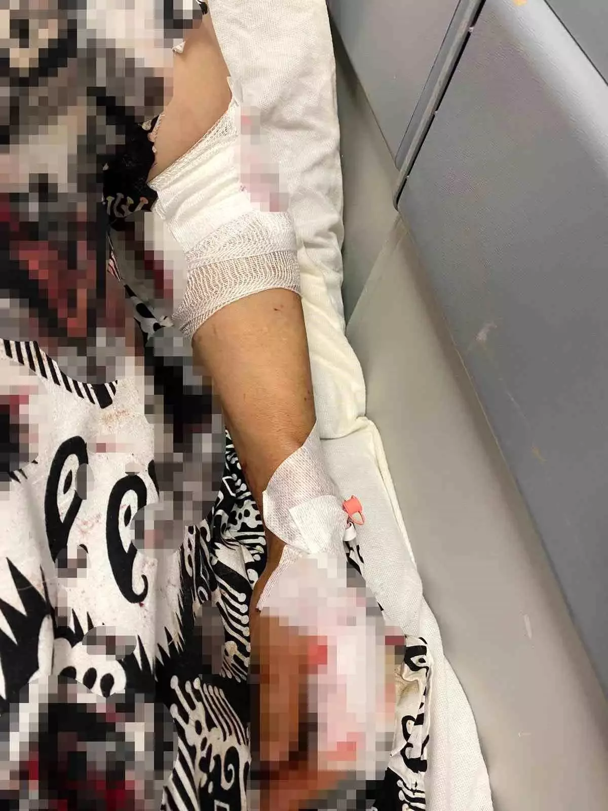 Su Kesintisi Sırasında Köpek Saldırısına Uğrayan Kadın Hastaneye Kaldırıldı