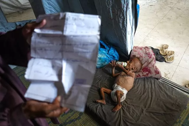 The cries of Gazan children dying of hunger are echoing! Shock upon shock for Israel