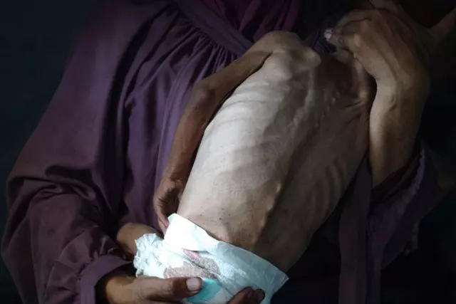 The cries of Gazan children dying of hunger are echoing! Shock upon shock for Israel