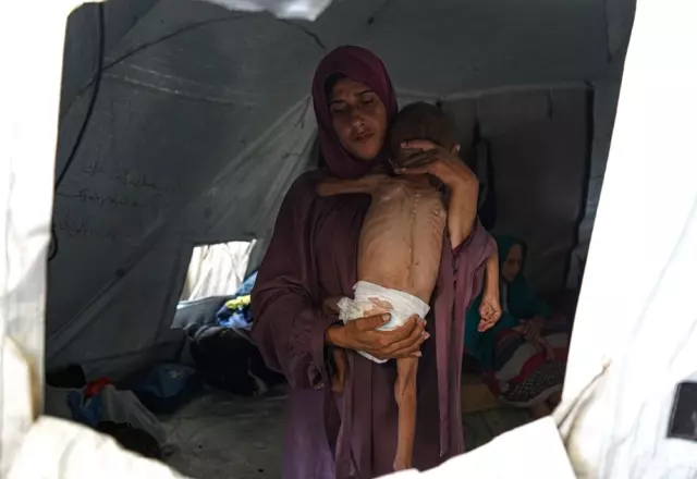 The cries of Gazan children dying of hunger are echoing! Shock upon shock for Israel