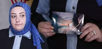 Karnında 15 santimlik hortum unuttular! Başhekimin açıklaması daha da skandal