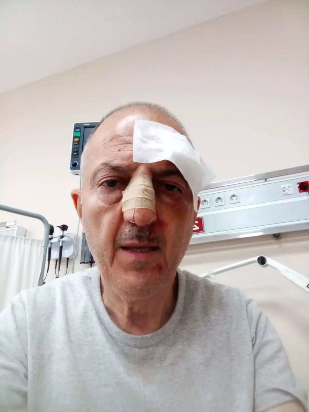 Boşanma Aşamasındaki Adam Kayınbiraderinin Saldırısına Uğradı
