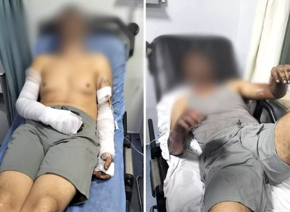 Manisa'da Sanayi Sitesinde Patlama: 2 Yaralı