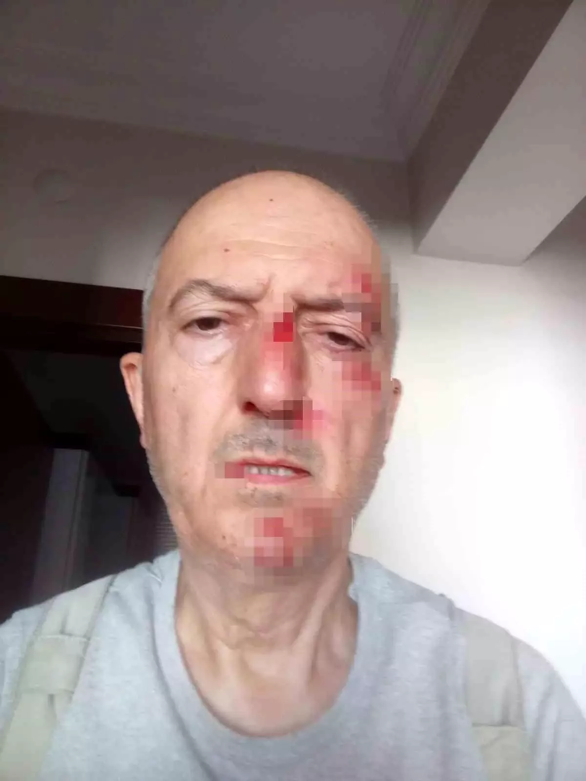 Afyonkarahisar'da Boşanma Sürecinde Darp Edilen Şahıs Hastanelik Oldu