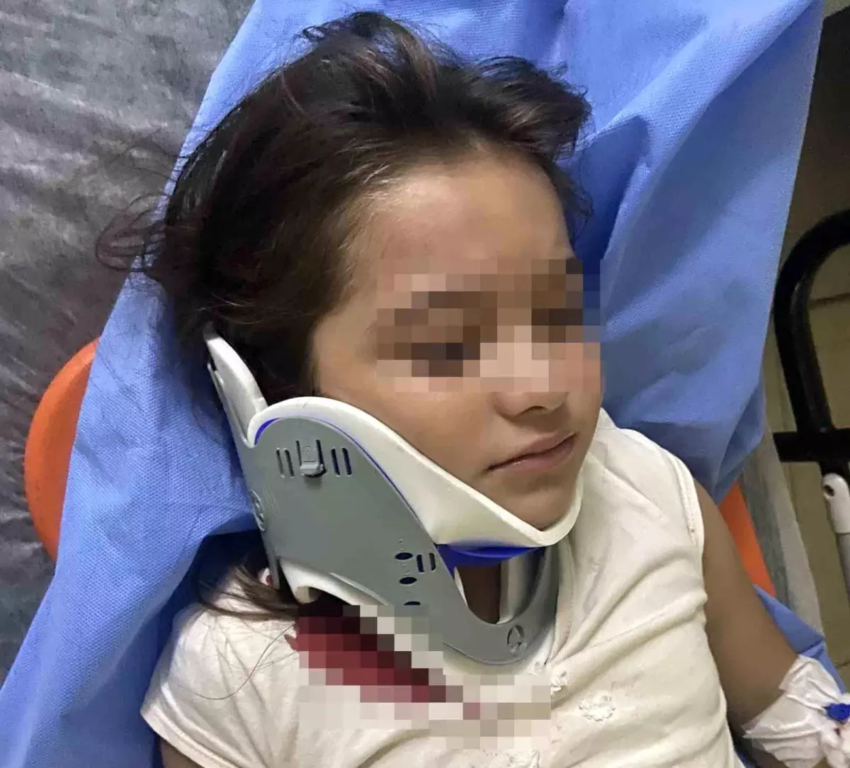 Ordu'da Scooter Kazası: 8 Yaşındaki Kız Yaralandı