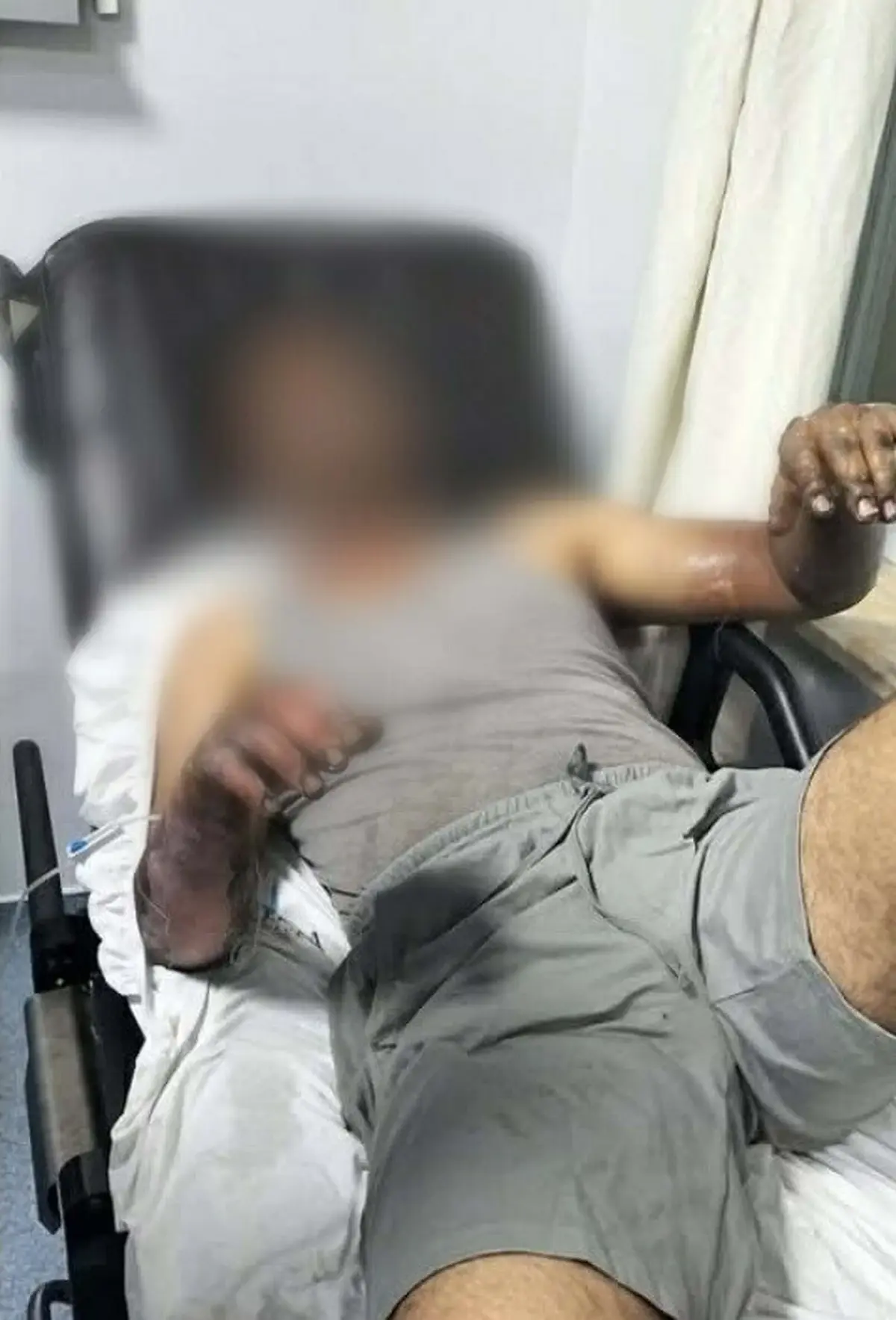 Manisa'da Oto Tamirhanesinde Patlama: 2 Yaralı