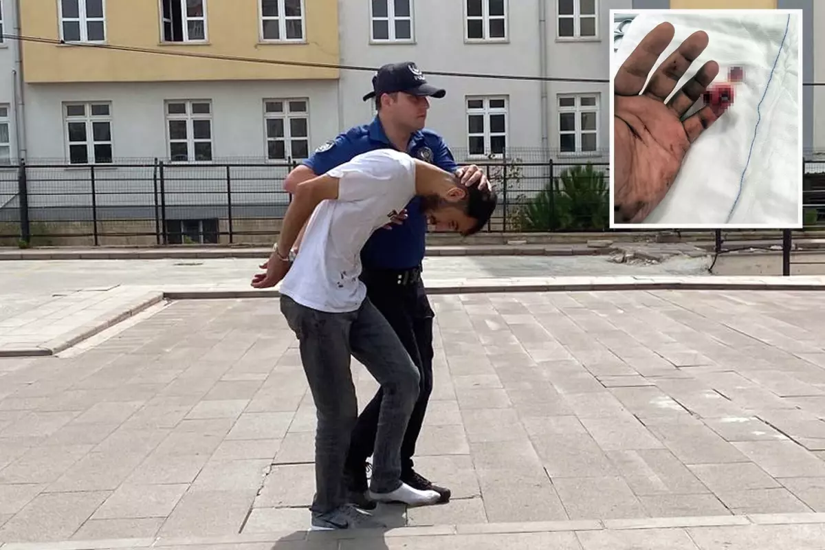 Uyuşturucu operasyonunda vahşet: Polisin parmağını ısırarak kopardı