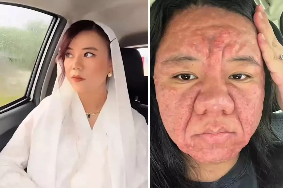 Yok böyle bir değişim: Bir anda onlarca yıl yaşlandı