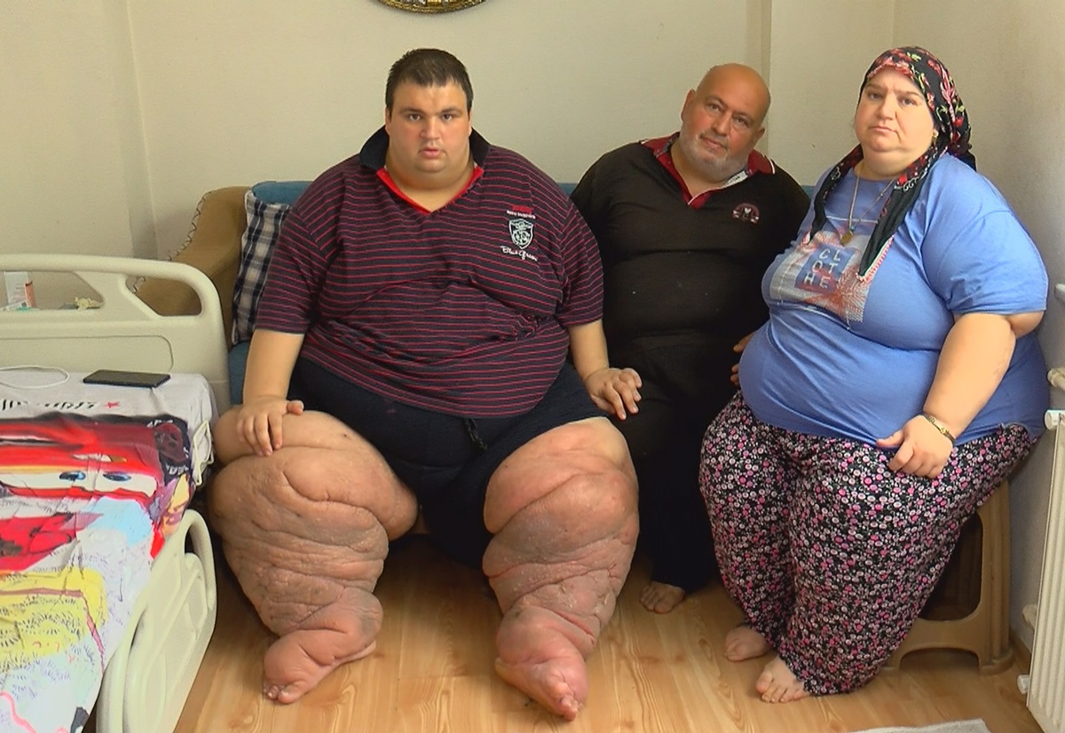 270 kilo Mehmet: 15 aydır evden çıkamıyorum, yardım edin