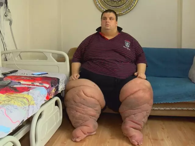 270 kilo mehmet 15 aydir evden cikamiyorum ya 2 18930037 o