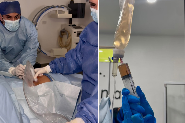 Kim Kardashian kök hücre tedavisine başladı