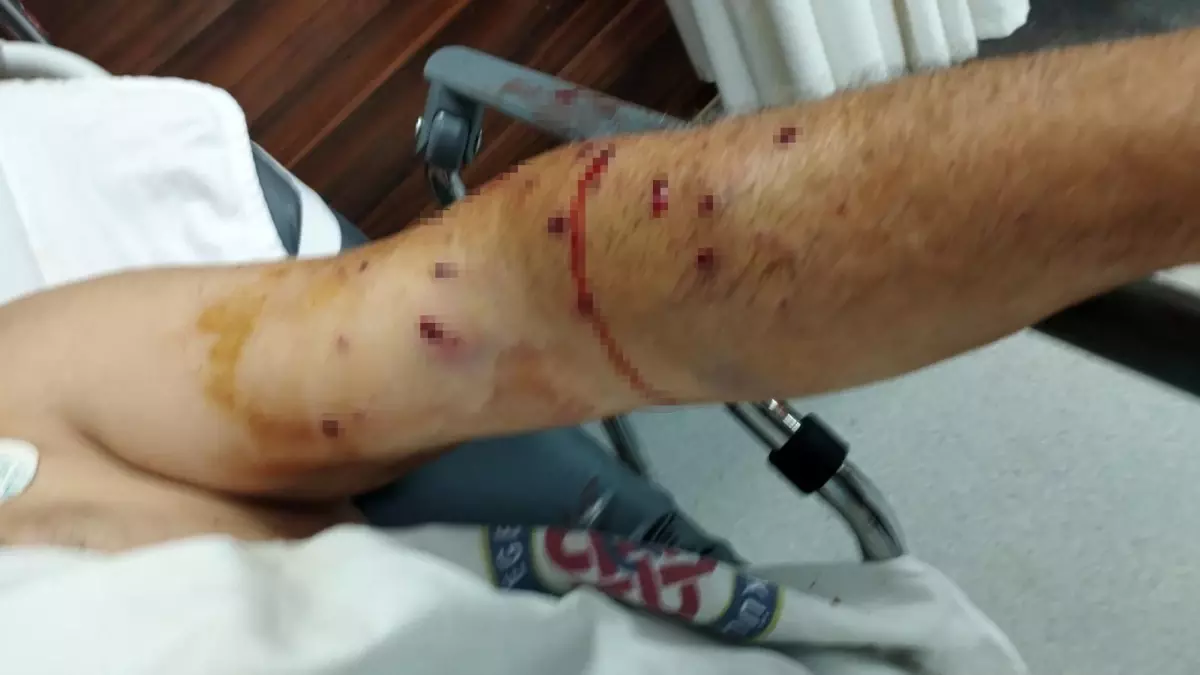 İzmir'de Tır Sahibinin Kantar Ücretine Sinirlenip Çalışanını Yaraladığı Olay