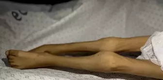 Gazze Şeridi'nde bir çocuk daha 'açlıktan' öldü! 3 kiloya kadar düşmüştü
