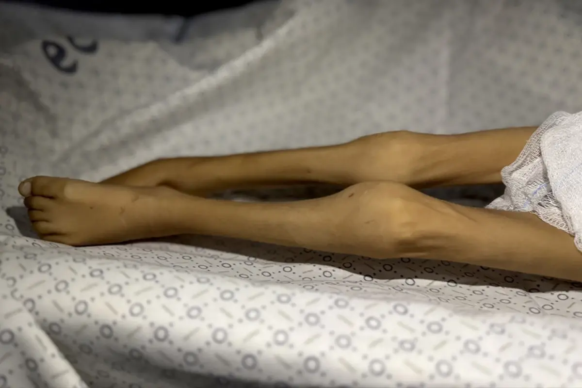 Gazze Şeridi'nde bir çocuk daha 'açlıktan' öldü! 3 kiloya kadar düşmüştü