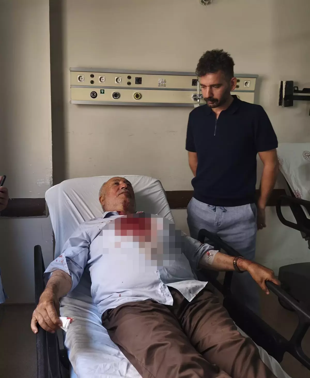 İmam Kavga Ayırırken Yumurta Darbesiyle Yaralandı