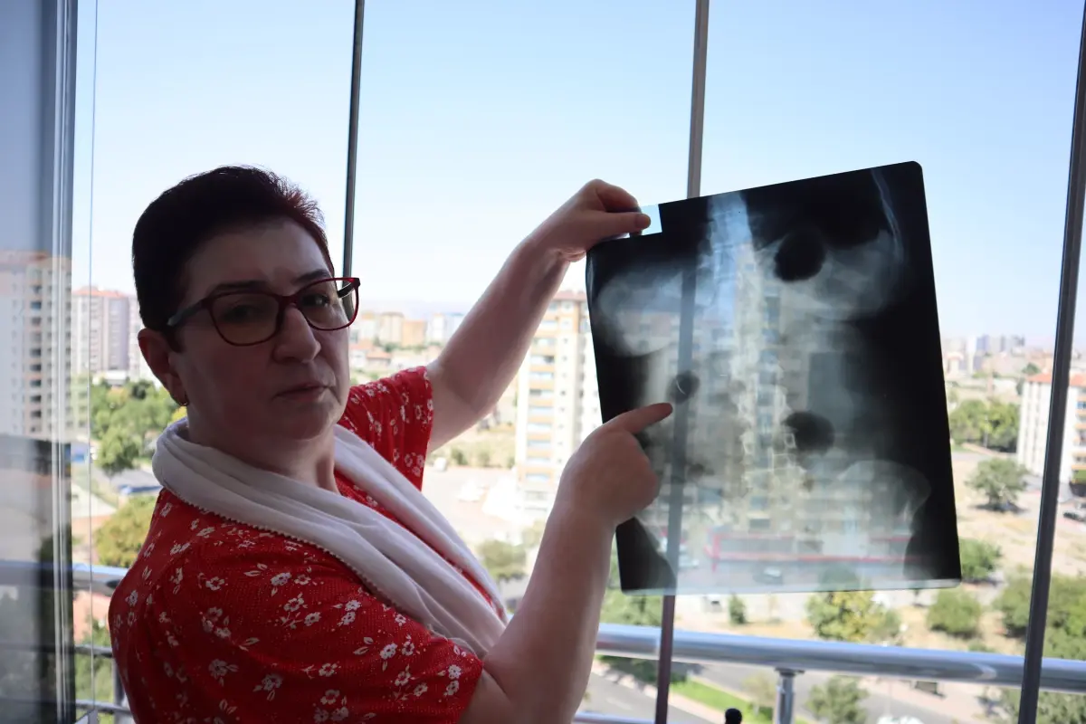 22 Yıldır Karnında Ameliyat İğnesiyle Yaşayan Kadın: 'Yaşayan Ölü Gibiyim'
