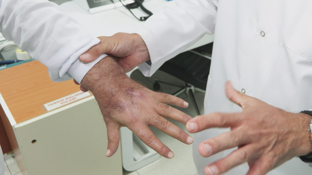 doktorlar bile sasirdi hirsiz elini oyle bir 18955444 1426 m