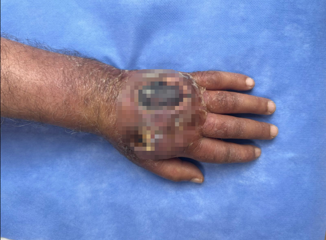 doktorlar bile sasirdi hirsiz elini oyle bir 18955444 568 m