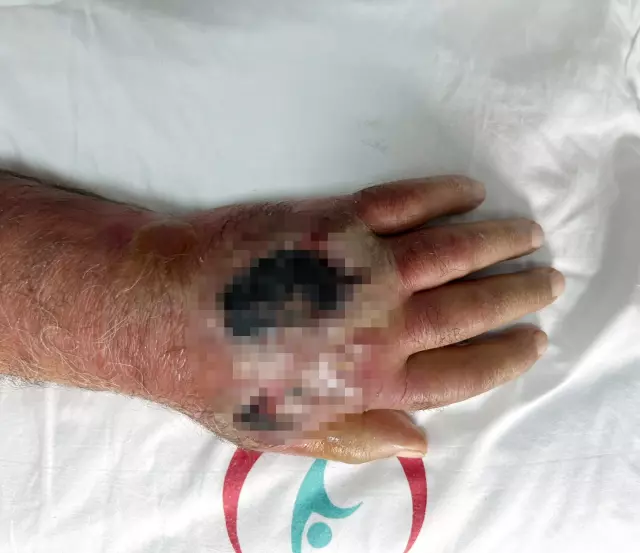 doktorlar bile sasirdi hirsiz elini oyle bir 18955444 7264 m
