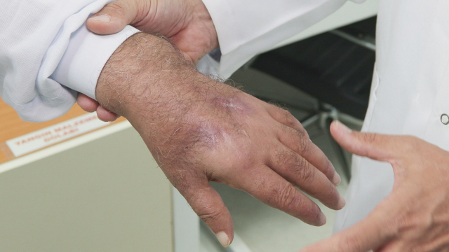 doktorlar bile sasirdi hirsiz elini oyle bir 18955444 7752 m