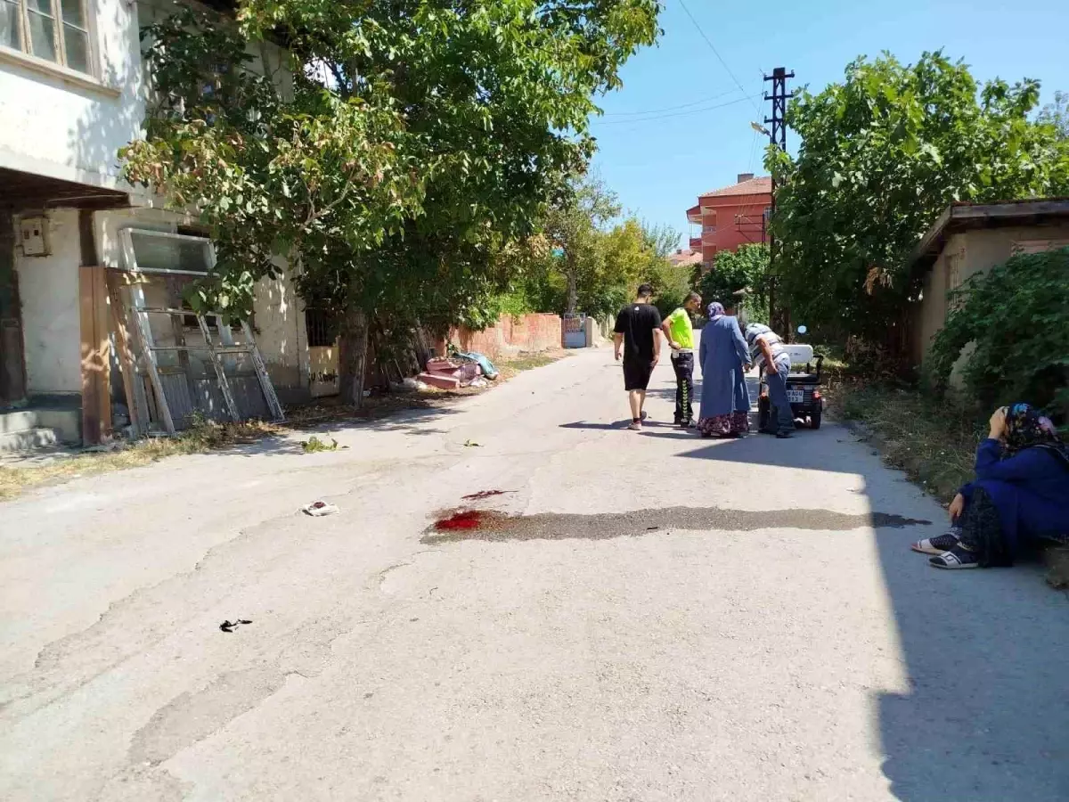 Çorum'da elektrikli motosiklet kazası: 1 yaralı