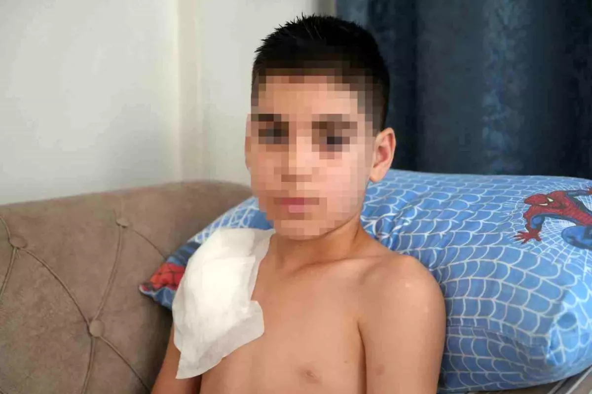 Sahipli Köpek Saldırısı 11 Yaşındaki Çocuğun Hayatını Kabusa Çevirdi
