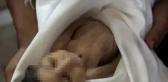 Gazze'de Açlık Sebebiyle Bir Bebek Daha Hayatını Kaybetti