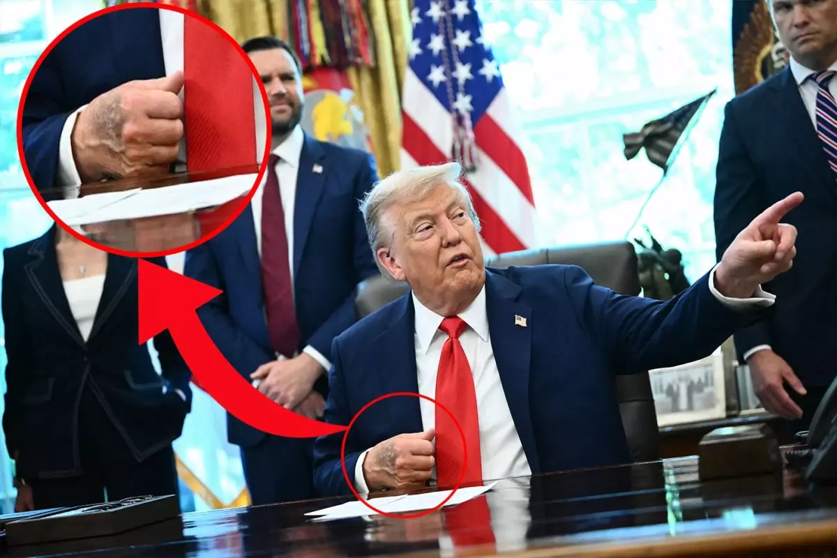 Trump'ın elindeki morluk dikkat çekti, Beyaz Saray 'Sık sık el sıkışmaktan' dedi