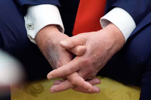 trump in elindeki morluk dikkat cekti beyaz 18981250 6552 m