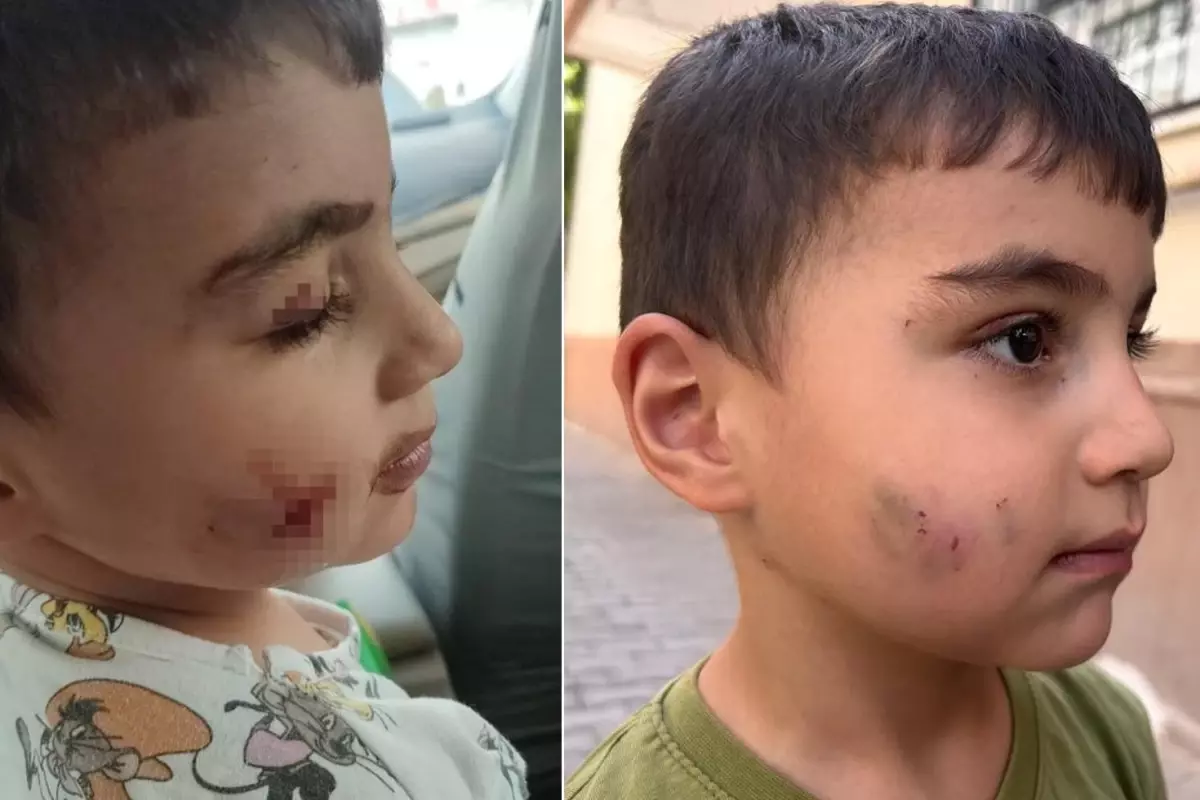 Ankara'nın göbeğinde lağım faresi uyuyan çocuğu ısırdı