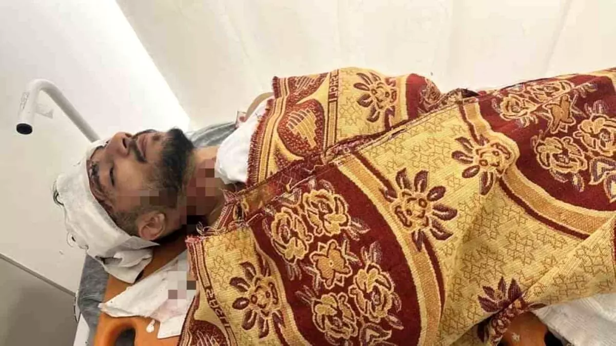 İstanbul'da Kamyonet ve Taksi Çarpıştı: Bir Yaralı