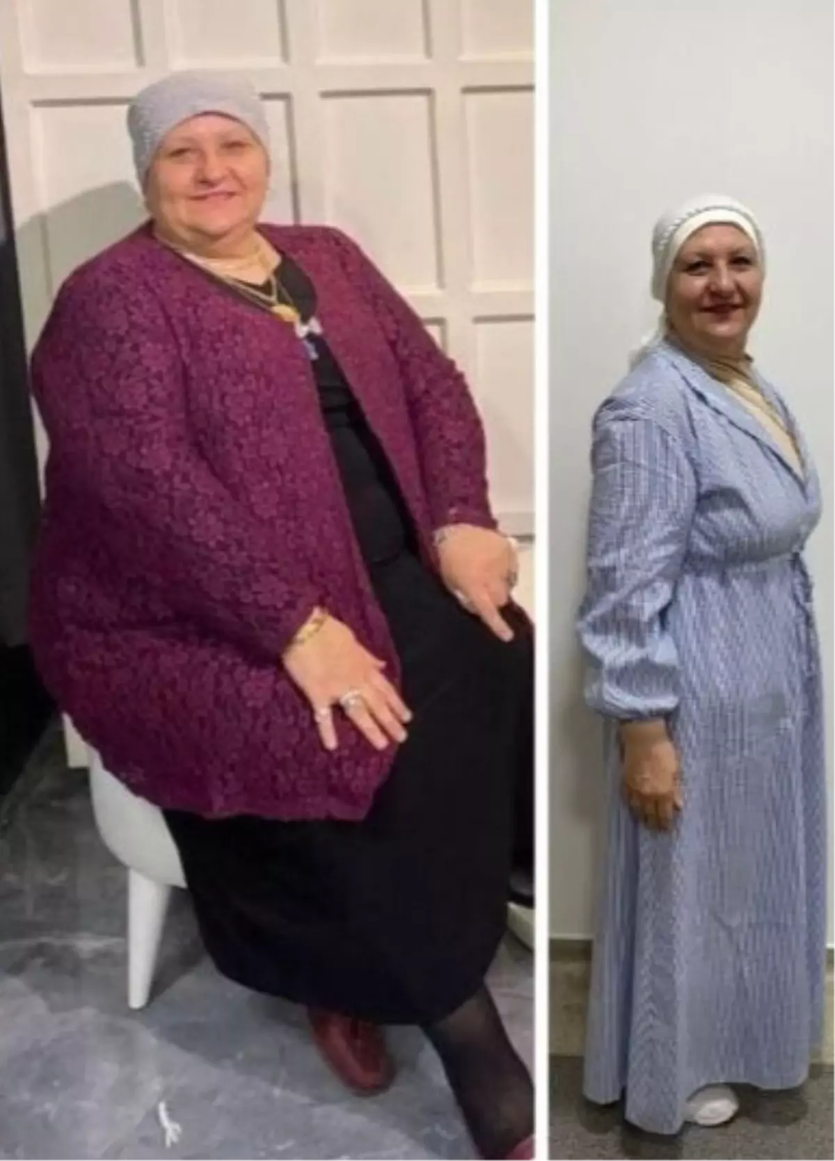 54 Yaşındaki Kadın 35 Kilo Vererek Sağlığına Kavuştu