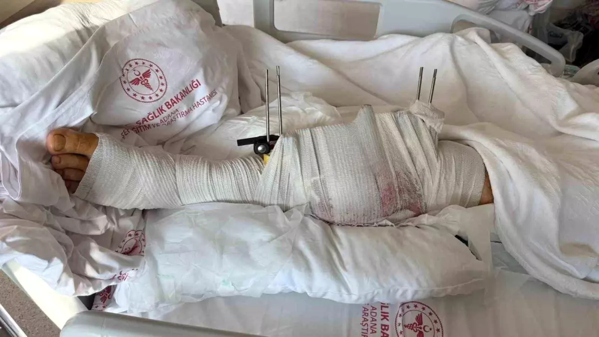 Muhtar, Eski Damadını Tabancayla Vurarak Yaraladı