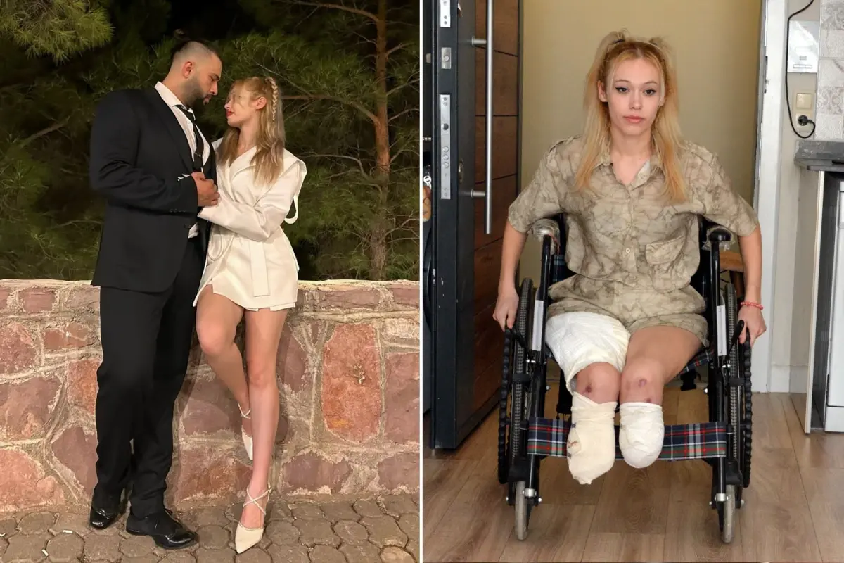 Evlilik yıl dönümünde kabusu yaşadı, 2 bacağını birden kaybetti