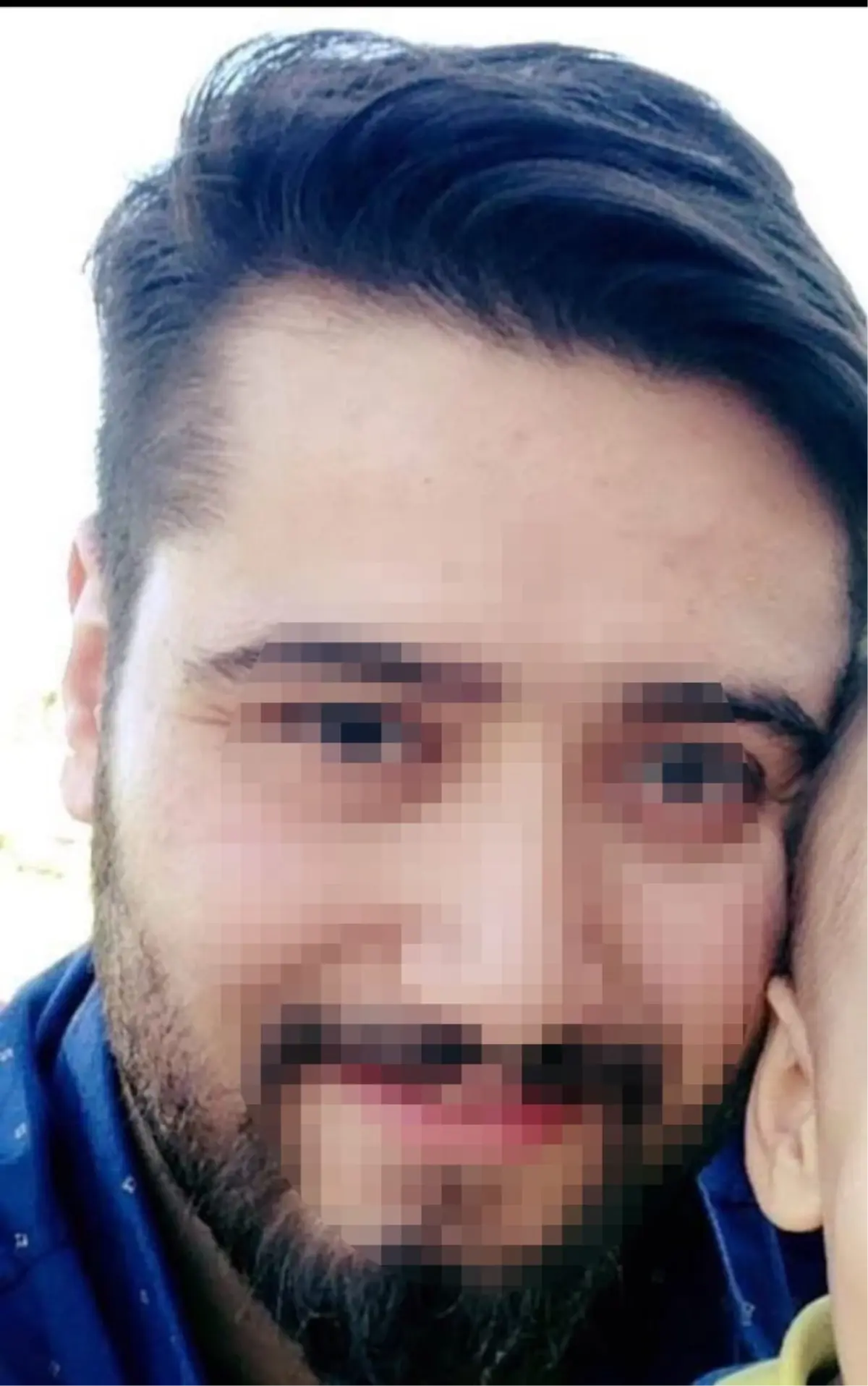Ankara'da Baba İki Oğlunu Bıçaklayıp İntihara Kalkıştı