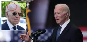 Eski ABD Başkanı Joe Biden cilt kanseri ameliyatı oldu