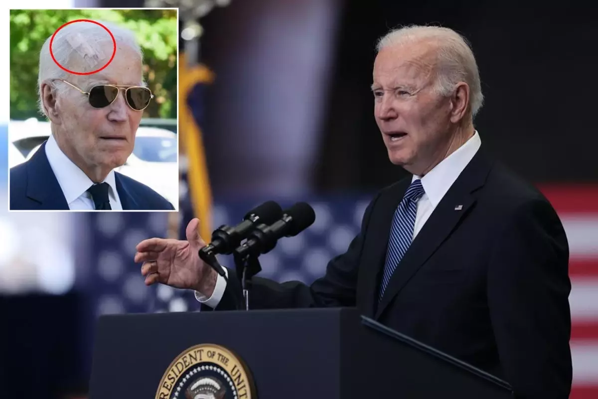Eski ABD Başkanı Joe Biden cilt kanseri ameliyatı oldu