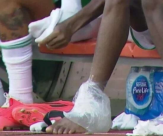 Bad news for Galatasaray fans! Victor Osimhen is injured