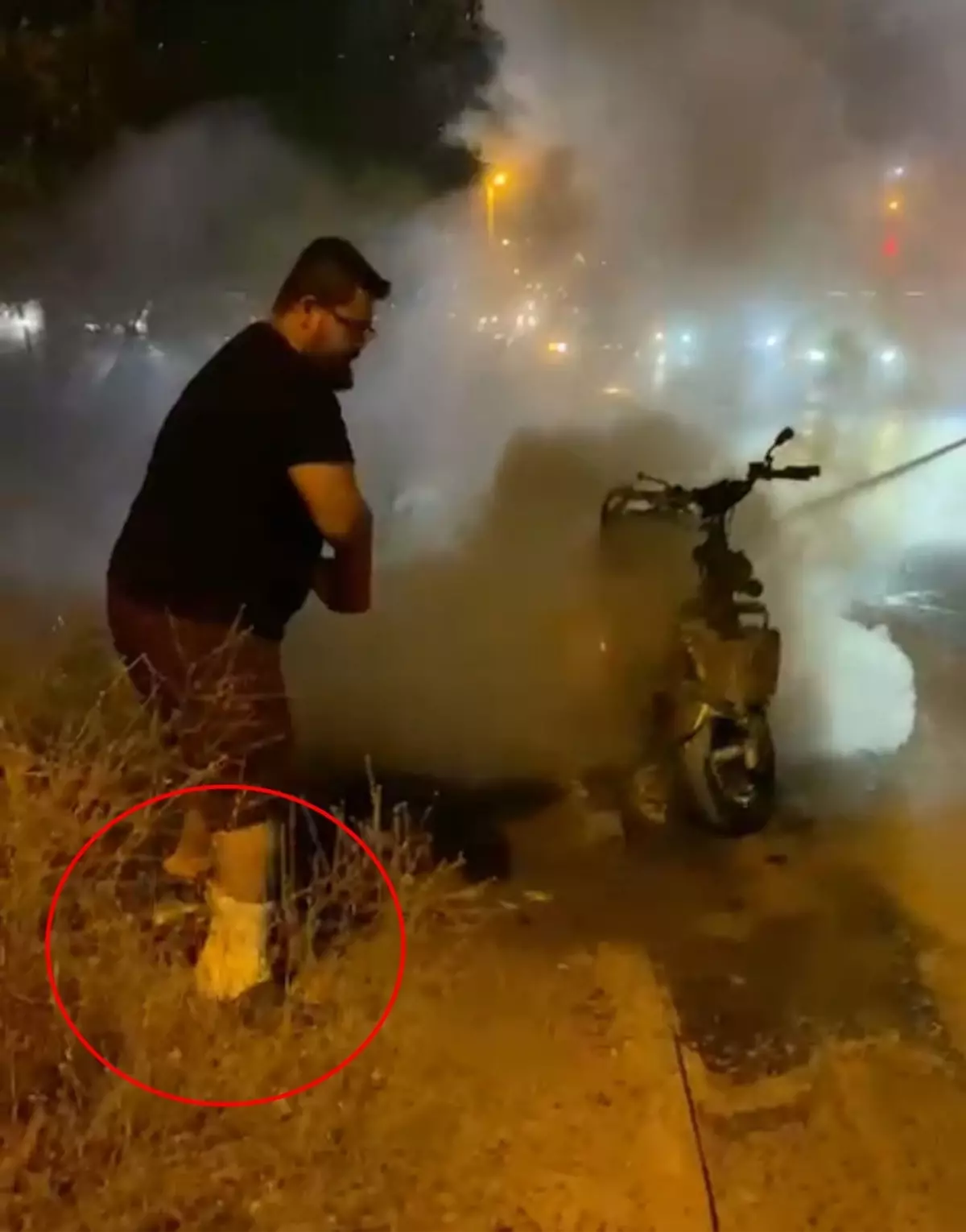 Bacağındaki Alçıya Rağmen Motosiklet Yangınını Söndürmeye Çalıştı