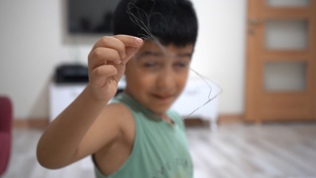 It was revealed that a catheter was left in the body of the child who started coughing after swallowing a cucumber.