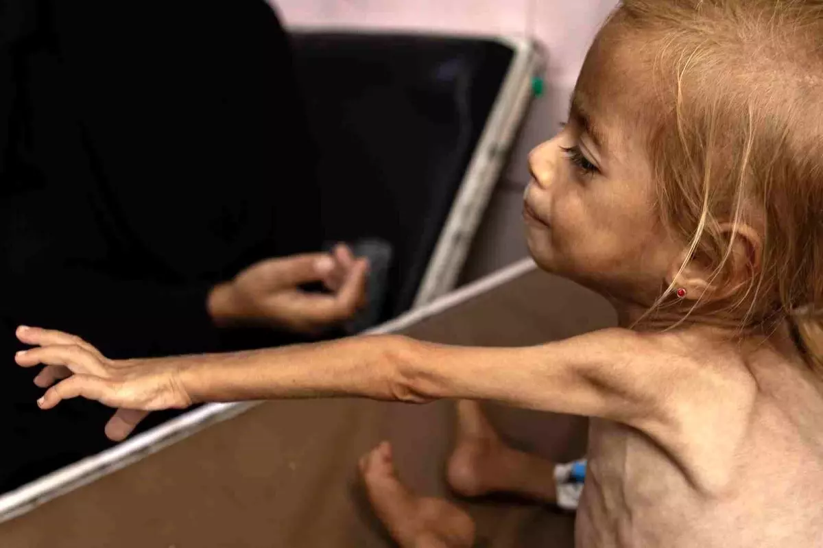 Gazze Şeridi'nde Son 24 Saatte 5 Sivil Açlık Nedeniyle Hayatını Kaybetti