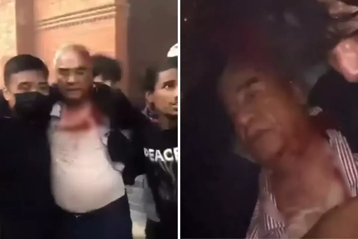 Nepal'de başbakan ve eşi, öfkeli kalabalık tarafından evlerinden çıkarılıp linç edildi
