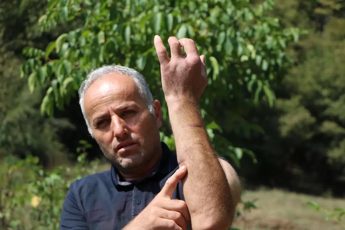 Bolu'da Ayı Saldırısında Bir Kişi Yaralandı