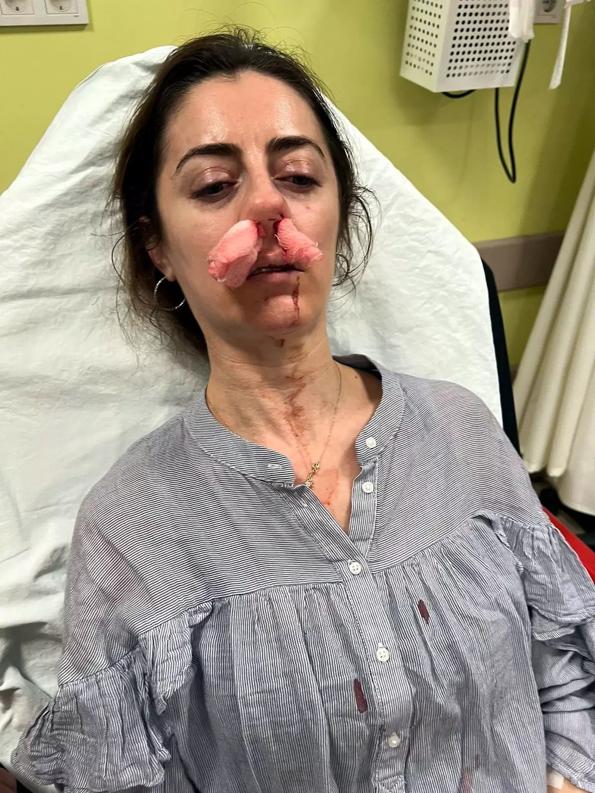 Eşinin Sevgilisi Zannettiği Kadına Saldıran Adam Hapsi İstendi