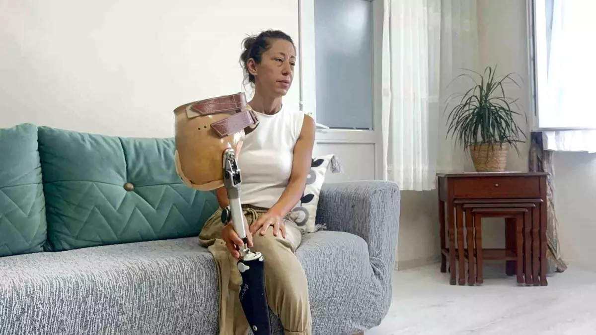 Kemik Kanseriyle Mücadele Eden Anne Yeni Protez İçin Yardım Bekliyor