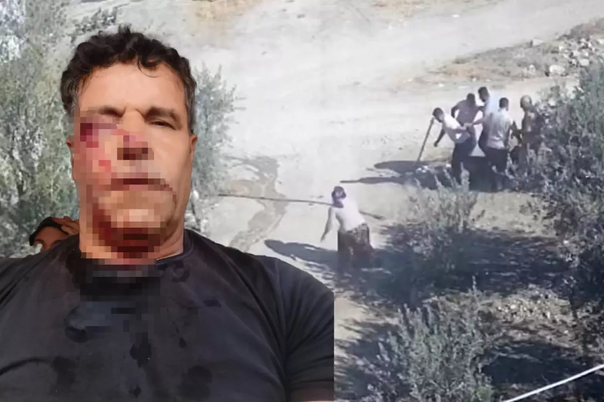 Kafasını taşla ezmek istediler, karısı düşünmeden müdahale etti