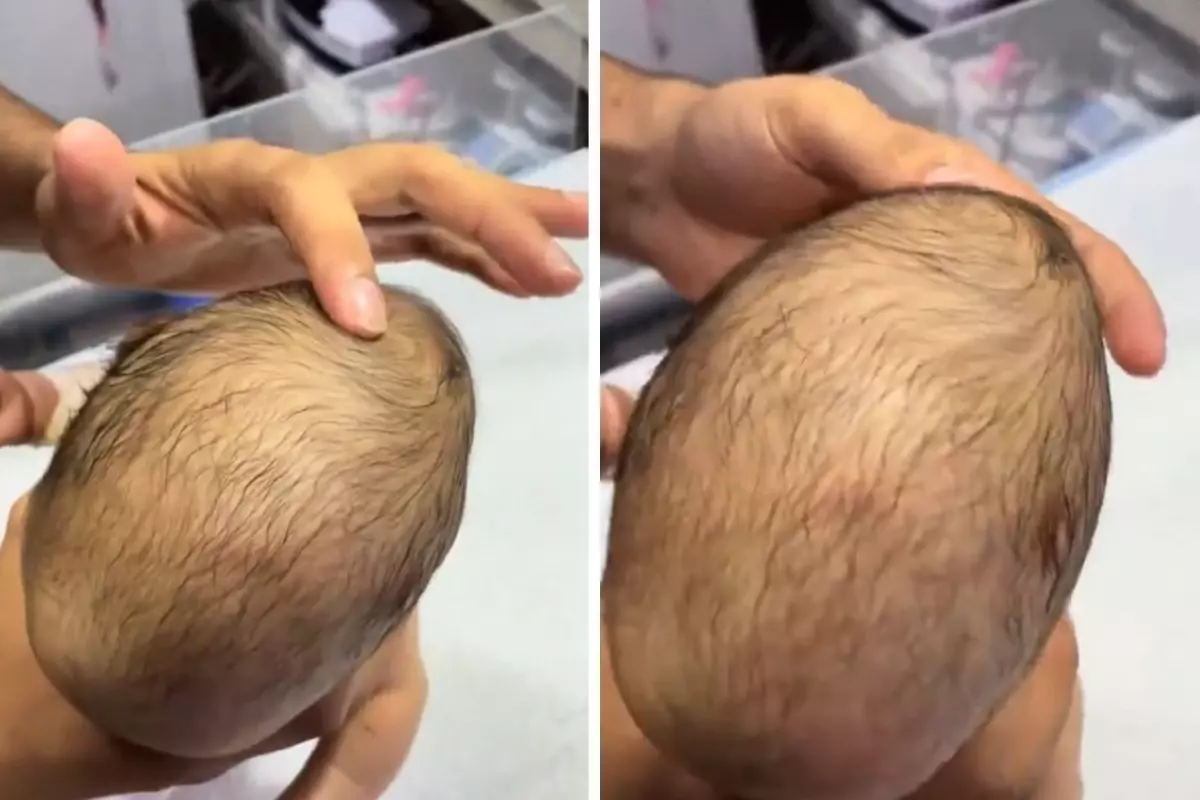 Yeni doğan bebeğin bıngıldağına basan doktorun gördüğü manzara korkunç