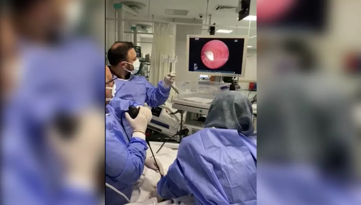 Osmaniye'de Yemeğin İçinde Sarımsak Kalbi Sıkıştırdı, Hastaya Operasyon Yapıldı